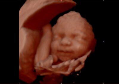 A sonogram of a baby smiling inside a womb