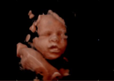 A sonogram of a baby named Johnson