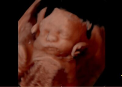 A sonogram of a baby with a cute face